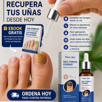 🤍 Nail Fungus Essence™ | Elimina los Hongos y Evita que Regresen